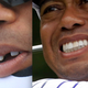 Illustration for article titled Hey, Heres A Photo Of Tiger Woods Without His Fake Front Tooth (Yes)